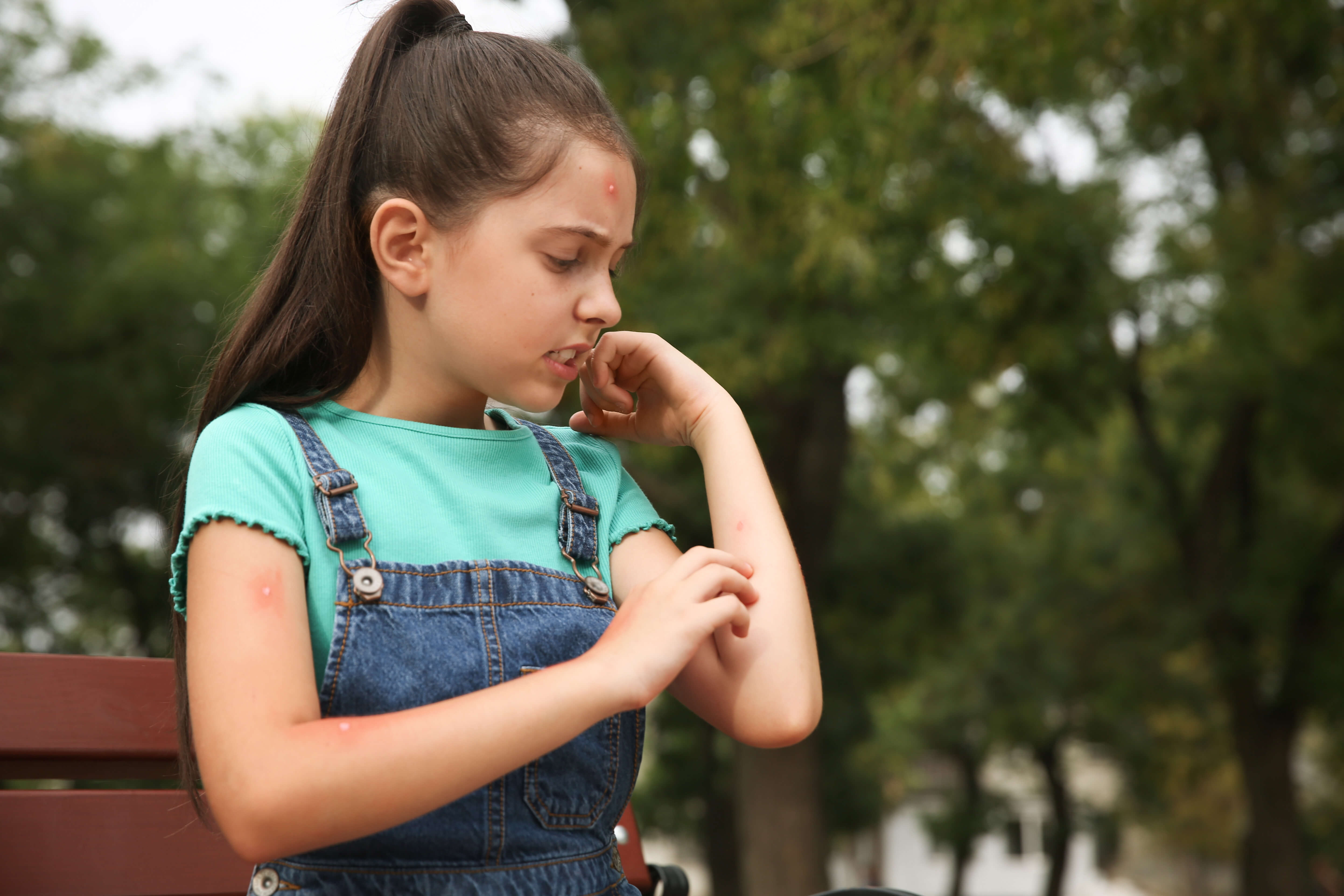 A girl itching her bug bites.
